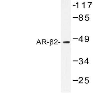 AR-(beta)2 (C378) pAb