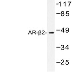 AR-(beta)2 (C378) pAb