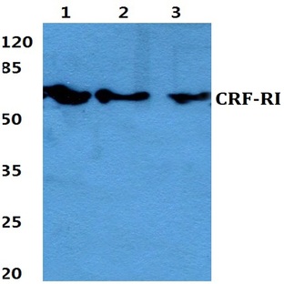 CRF-RI (H177) pAb