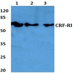 CRF-RI (H177) pAb