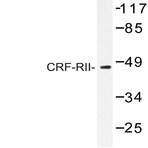 CRF-RII (Y113) pAb