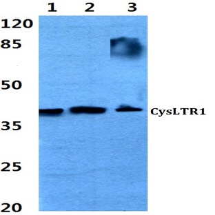 CysLTR1 (C173) pAb