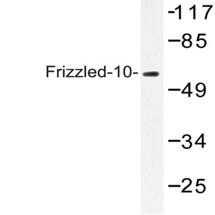 Frizzled-10 (L164) pAb