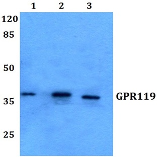 GPR119 (V227) pAb