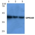 GPR160 (I337) pAb