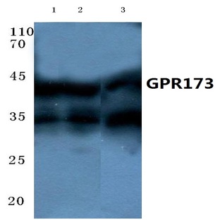 GPR173 (Y289) pAb