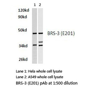 BRS-3 (E201) pAb