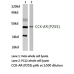 CCK-AR (P255) pAb