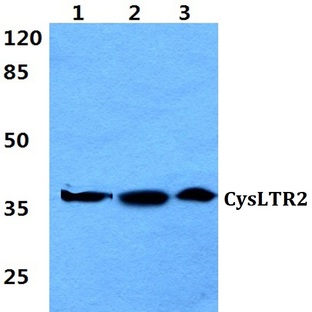 CysLTR2 (K322) pAb