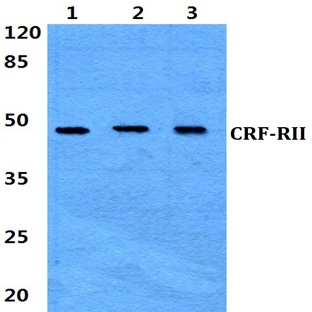 CRF-RII (H112) pAb