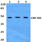 CRF-RII (H112) pAb