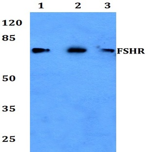 FSHR (R247) pAb