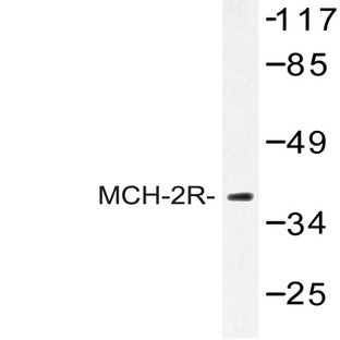 MCH-2R (M332) pAb