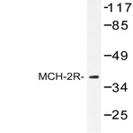 MCH-2R (M332) pAb