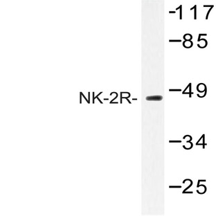 NK-2R (P340) pAb