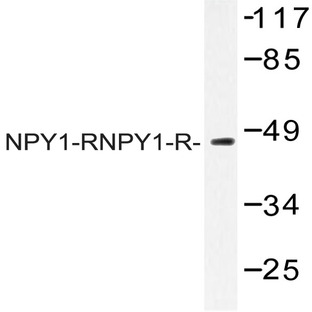 NPY1-R (R254) pAb