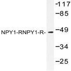 NPY1-R (R254) pAb