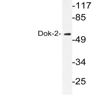 Dok-2 (R293) pAb