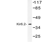 Kir6.2 (V220) pAb