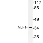 Mcl-1 (S155) pAb