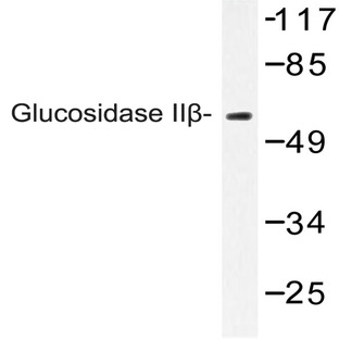 Glucosidase II(beta) (K117) pAb