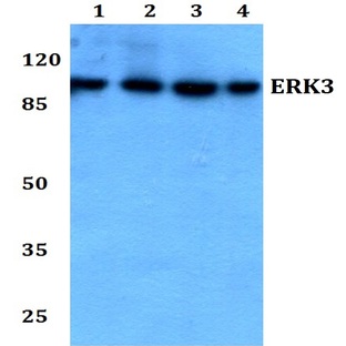 ERK3 (D475) pAb