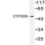 CYP2D6 (A277) pAb