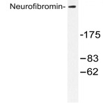 Neurofibromin (R1575) pAb