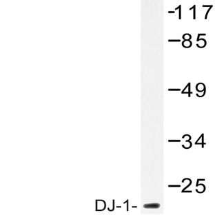 PARK7 / DJ-1 (A87) pAb