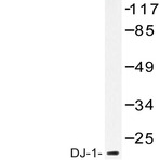 PARK7 / DJ-1 (A87) pAb