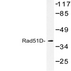 Rad51D (A152) pAb