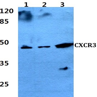 CXCR-3 (H202) pAb