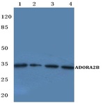 ADORA2B (W270) pAb