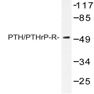 PTH/PTHrP-R (L187) pAb