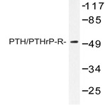 PTH/PTHrP-R (L187) pAb