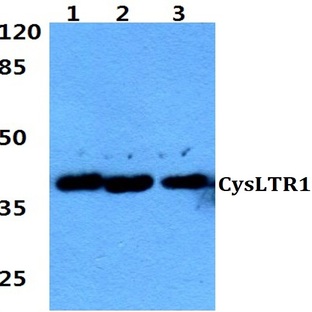 CysLTR1 (K172) pAb