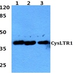 CysLTR1 (K172) pAb