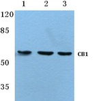 CB1 (F189) pAb