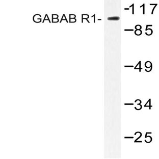 GABAB R1 (P931) pAb