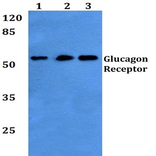 Glucagon Receptor (K136) pAb