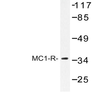 MC1-R (V312) pAb