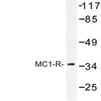 MC1-R (V312) pAb