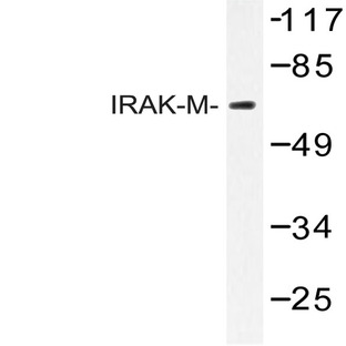 IRAK-M (L519) pAb