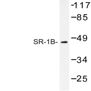 SR-1B (M305) pAb