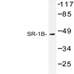 SR-1B (M305) pAb