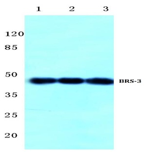 BRS-3 (C203) pAb