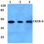 Bs2771_wb