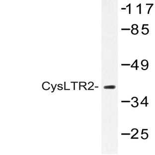 CysLTR2 (H324) pAb