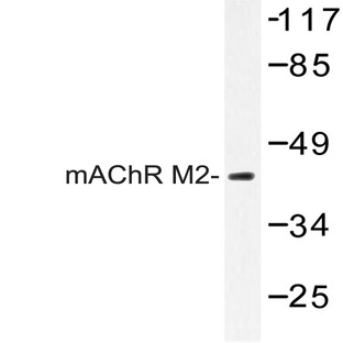 mAChR M2 (P224) pAb