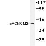 mAChR M2 (P224) pAb